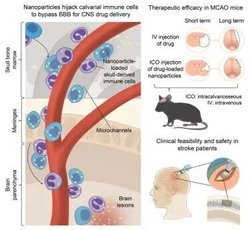 颠覆中风治疗！首创免疫细胞快递疗法，中风治疗效率提升15倍