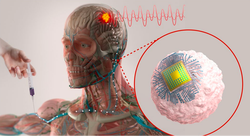 打一针就能治疗大脑疾病，麻省理工黑科技登顶 Nature 子刊